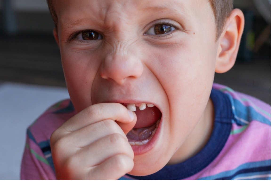 A picture containing person, child, little, loose tooth