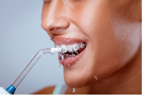 Close-up of a person's mouth with a water flosser or irrigator