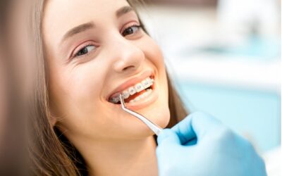 Dentist or Orthodontist: Which One for Straightening Your Teeth?