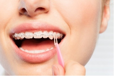 A close-up of a person cleaning their braces