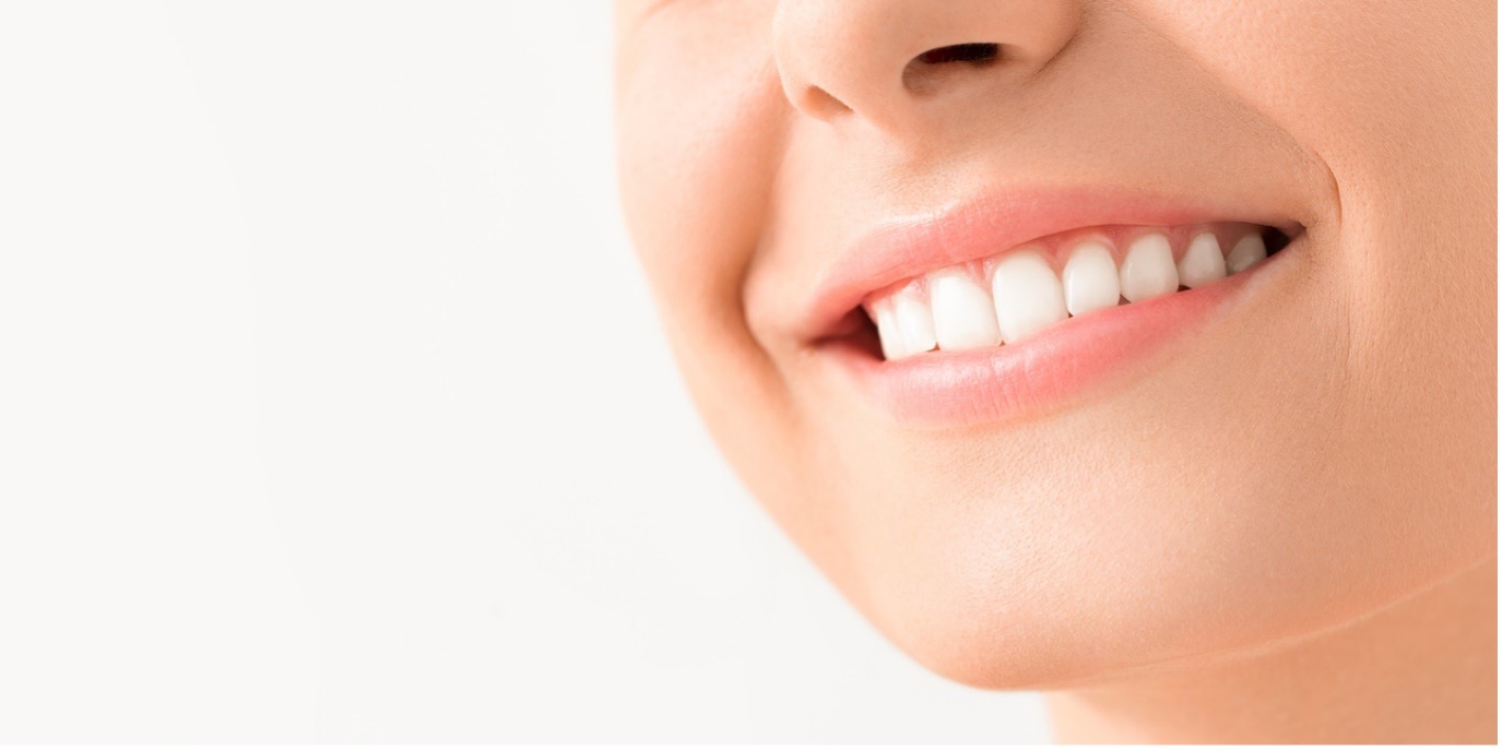 Close-up of a person's smile, Fixing an Overbite: Orthodontic Treatment for a Perfect Smile
