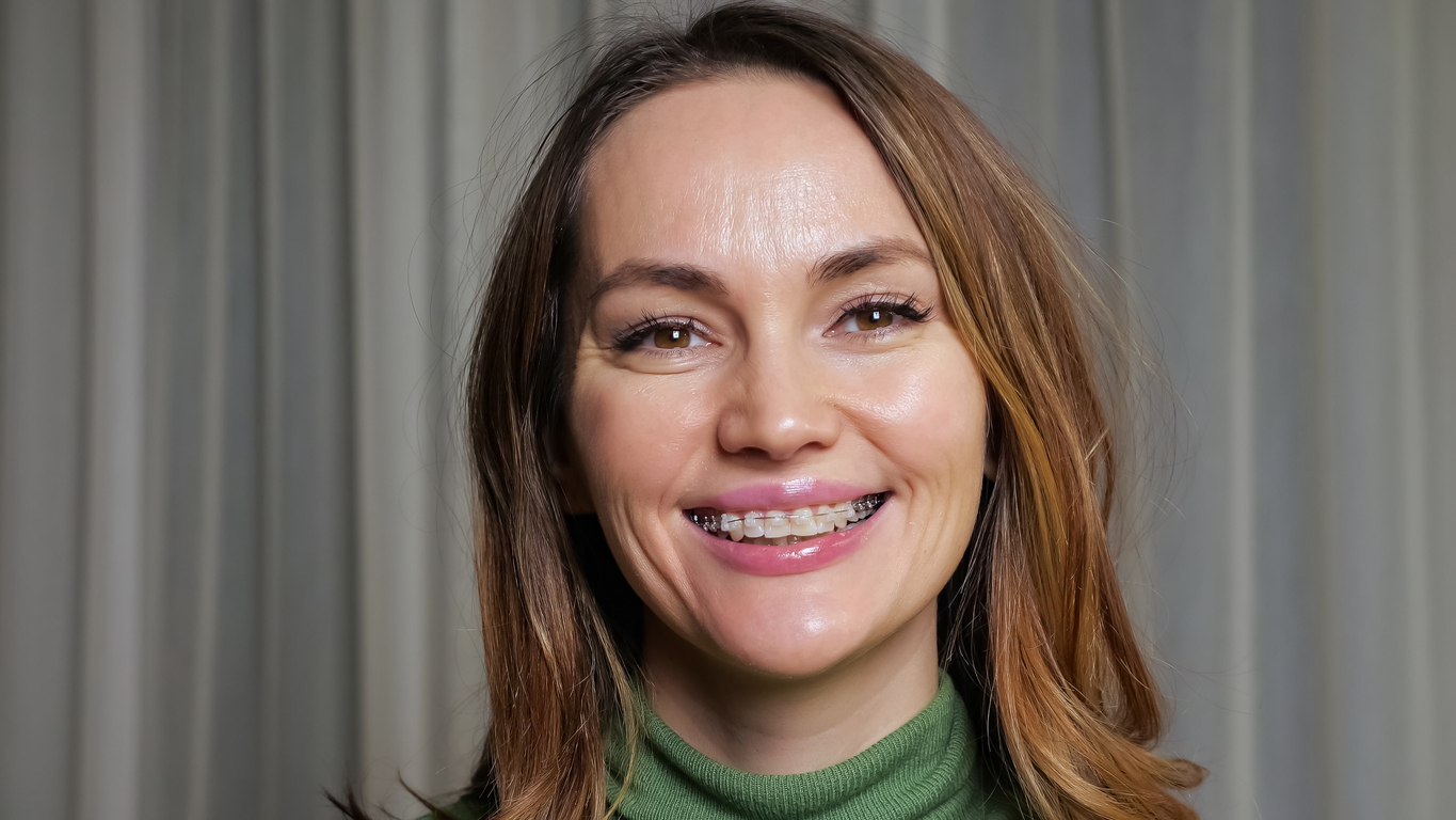 Braces for Adults in Greensboro & Randleman, A woman with braces smiling
